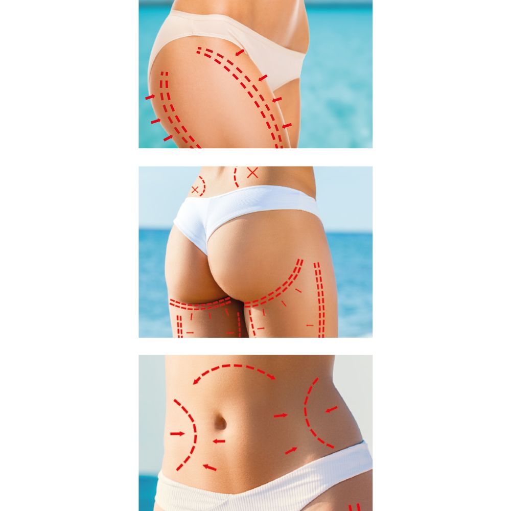 Trois images de parties du corps avec des marques rouges. Sur fond bleu clair.