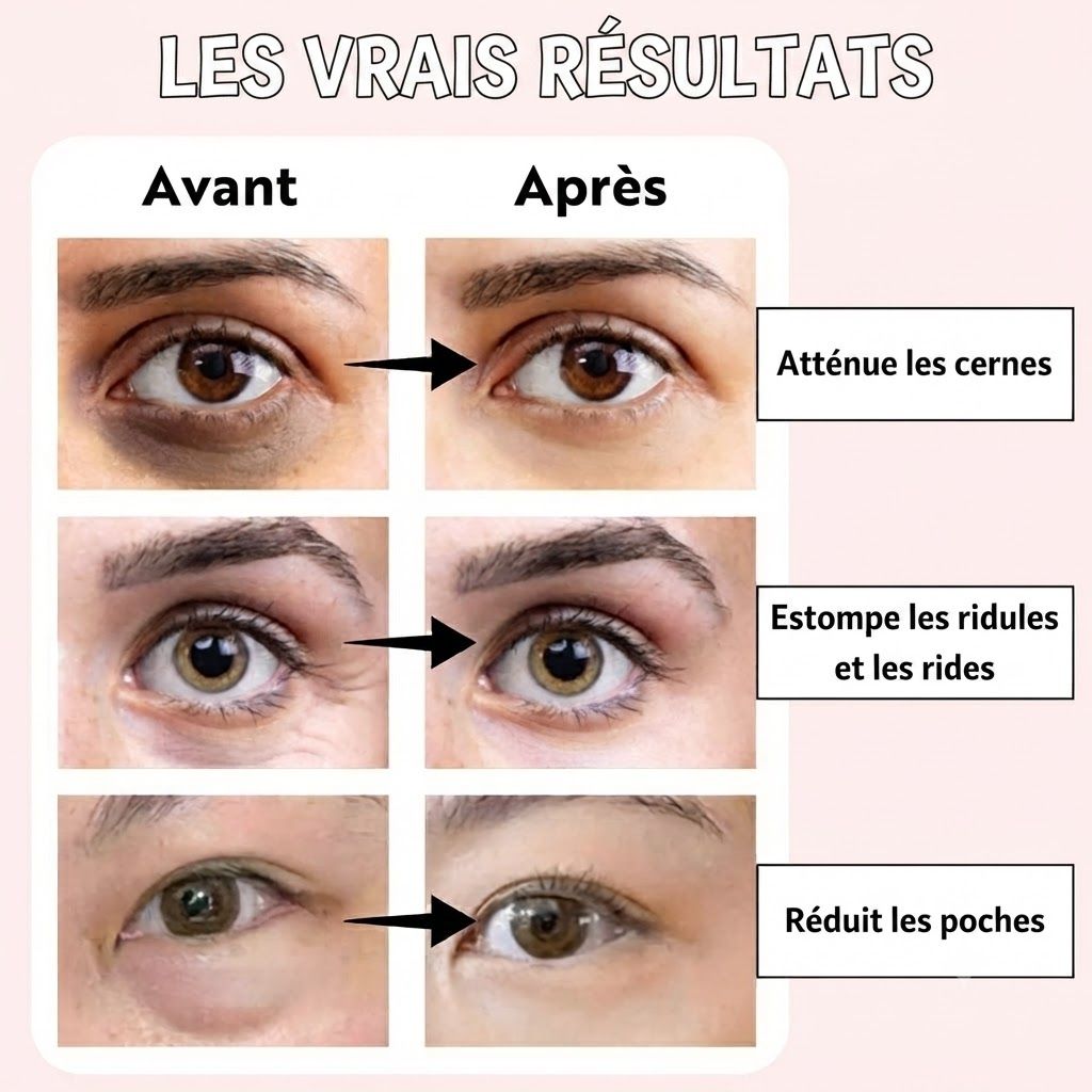 SUMMISHI Soin Coréen Ginseng + Rétinal Crème Contour des Yeux & Patchs Yeux