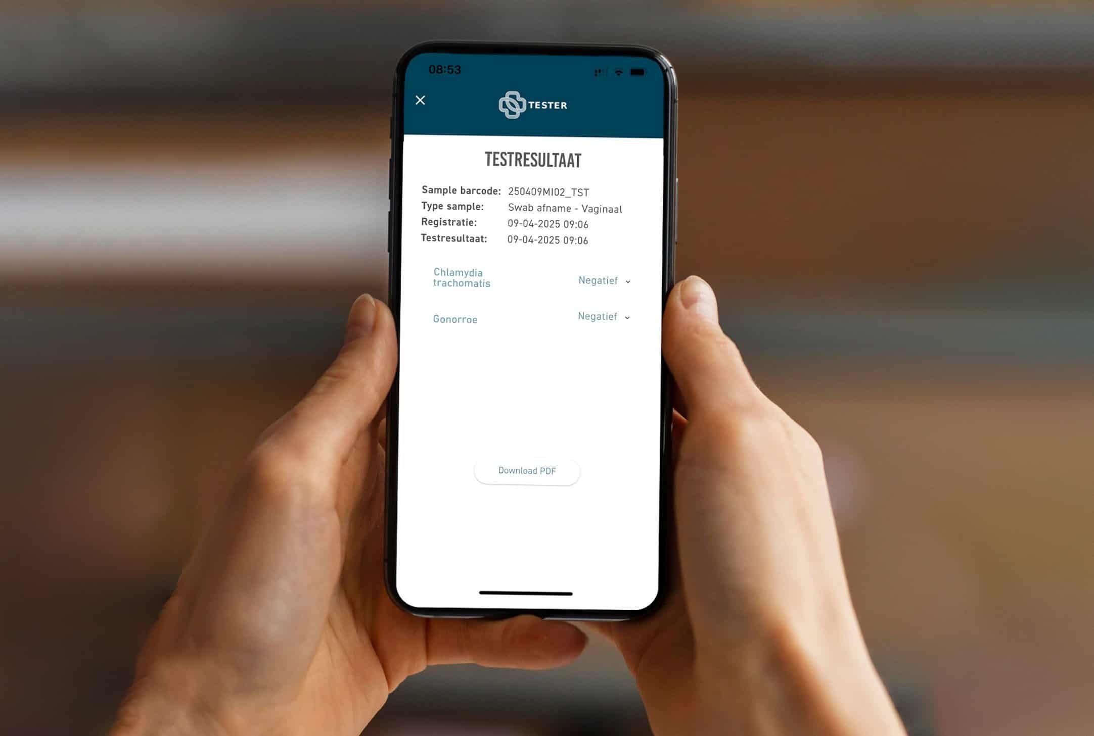 Smartphone affichant le résultat du test Chlamydia & Gonorrhée.