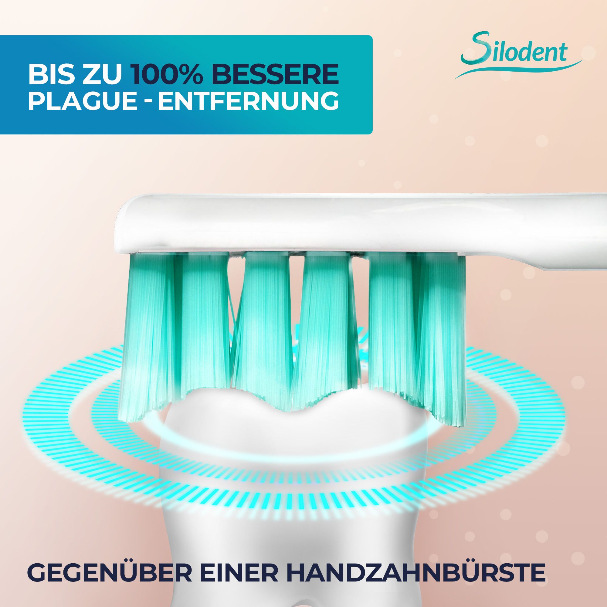 Silodent sonische tandenborstel in actie voor tandplakverwijdering, vergeleken met een handtandenborstel.
