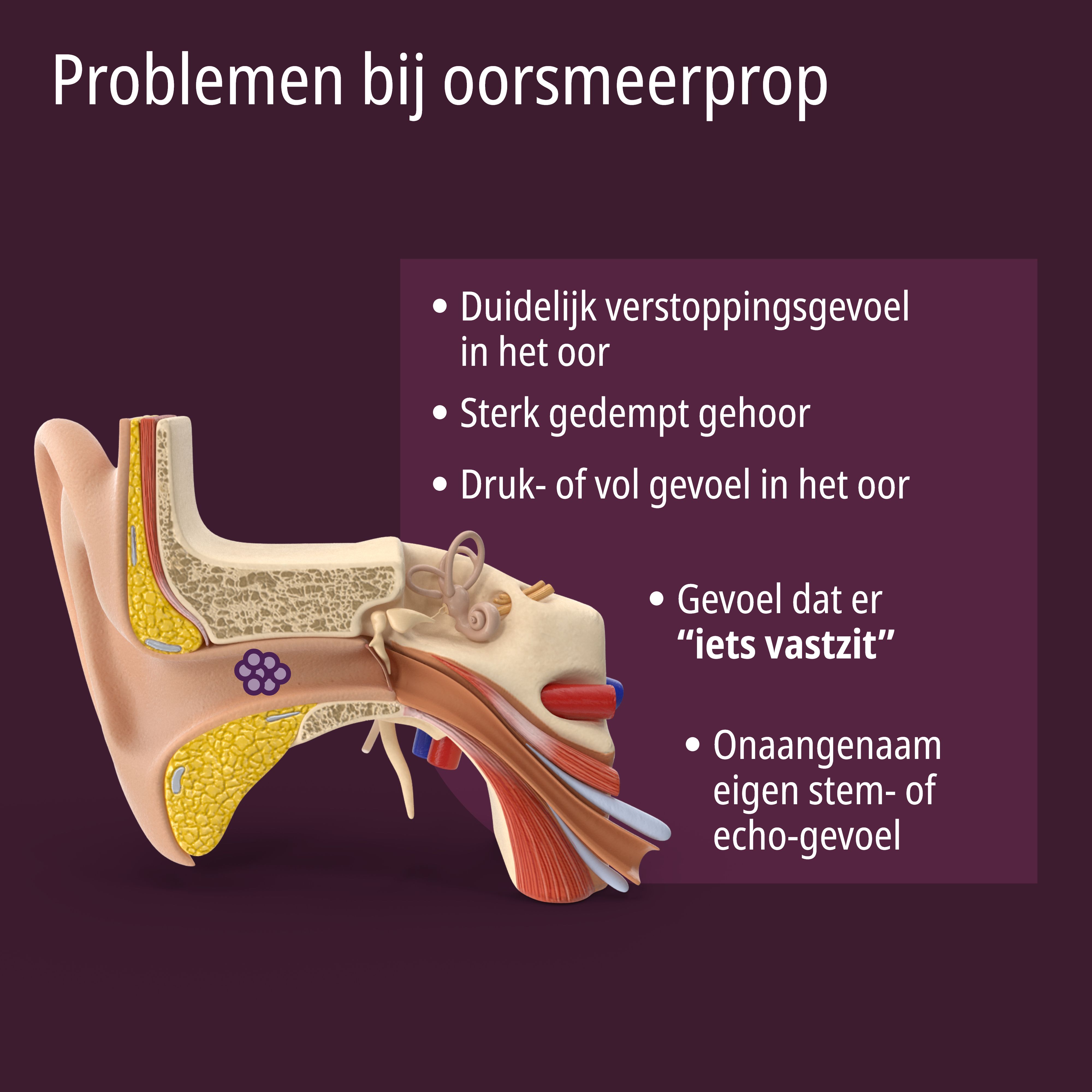 EVOLSIN® Anti-Oorsmeer: waarschuwing over de toepassingdiepte in de gehoorgang.