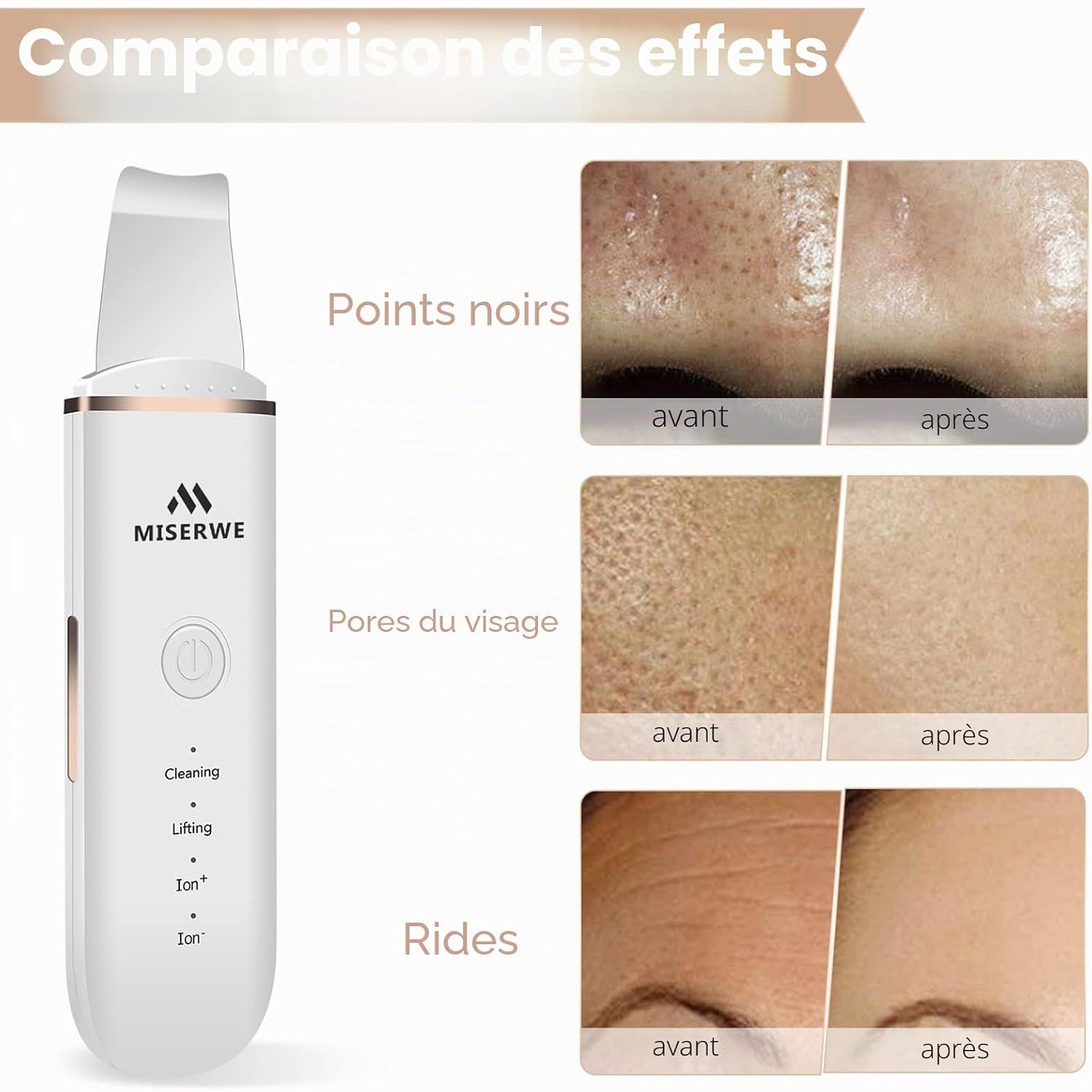 Un appareil de soin de la peau blanc de marque MISERWE, conçu pour le nettoyage en profondeur et le raffermissement de la peau. Il possède une pointe métallique fine et divers modes tels que Cleaning, Lifting et Ion.