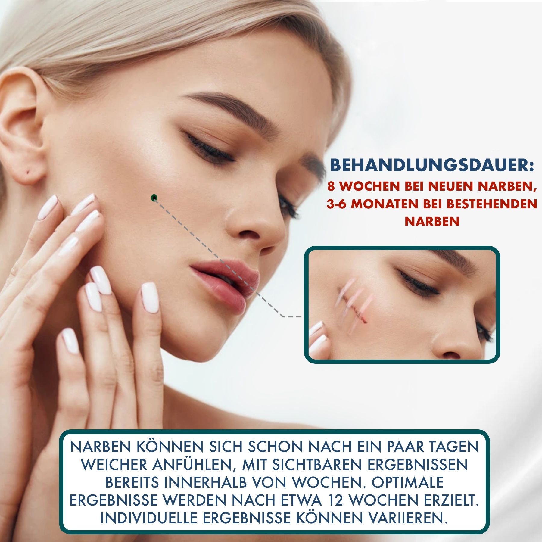 Vrouw met littekenbehandeling, toont voor-na-foto's en behandelduur.
