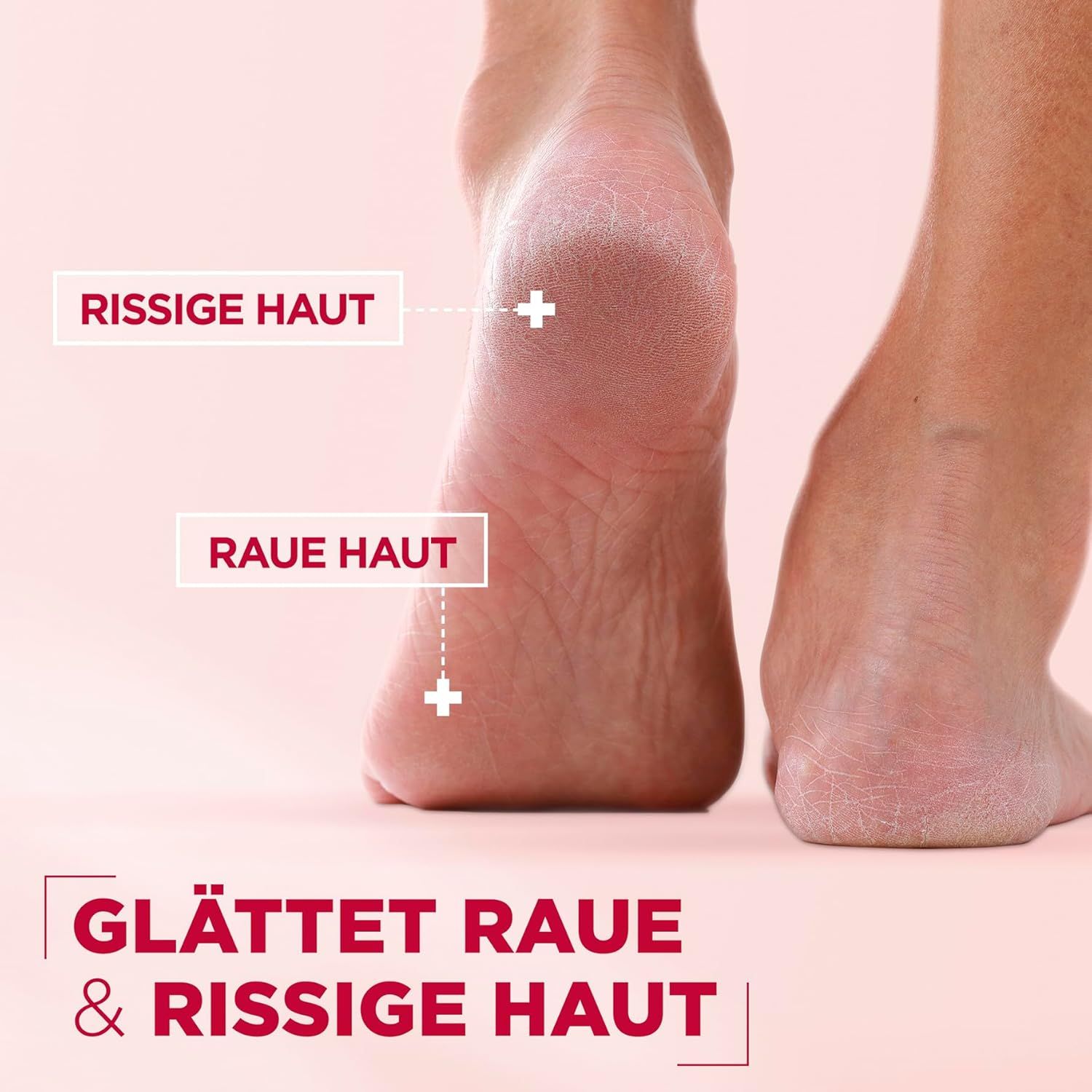 Close-up van voeten. Tekst: Gebarsten huid, ruwe huid. Tekst: Verzacht ruwe en gebarsten huid.