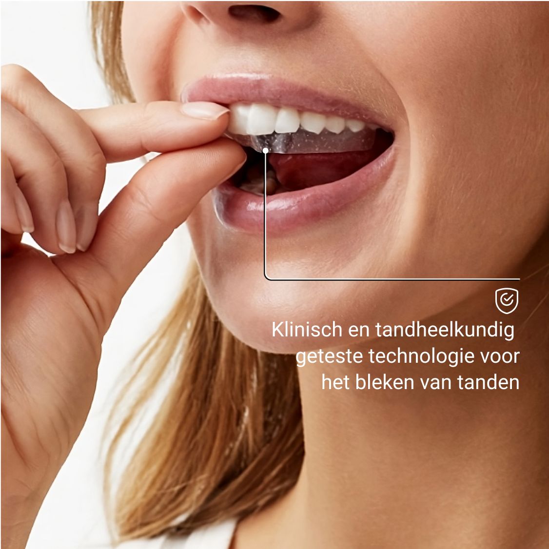 Vrouw die whitening strips in haar mond plaatst. Klinisch en tandheelkundig getest.
