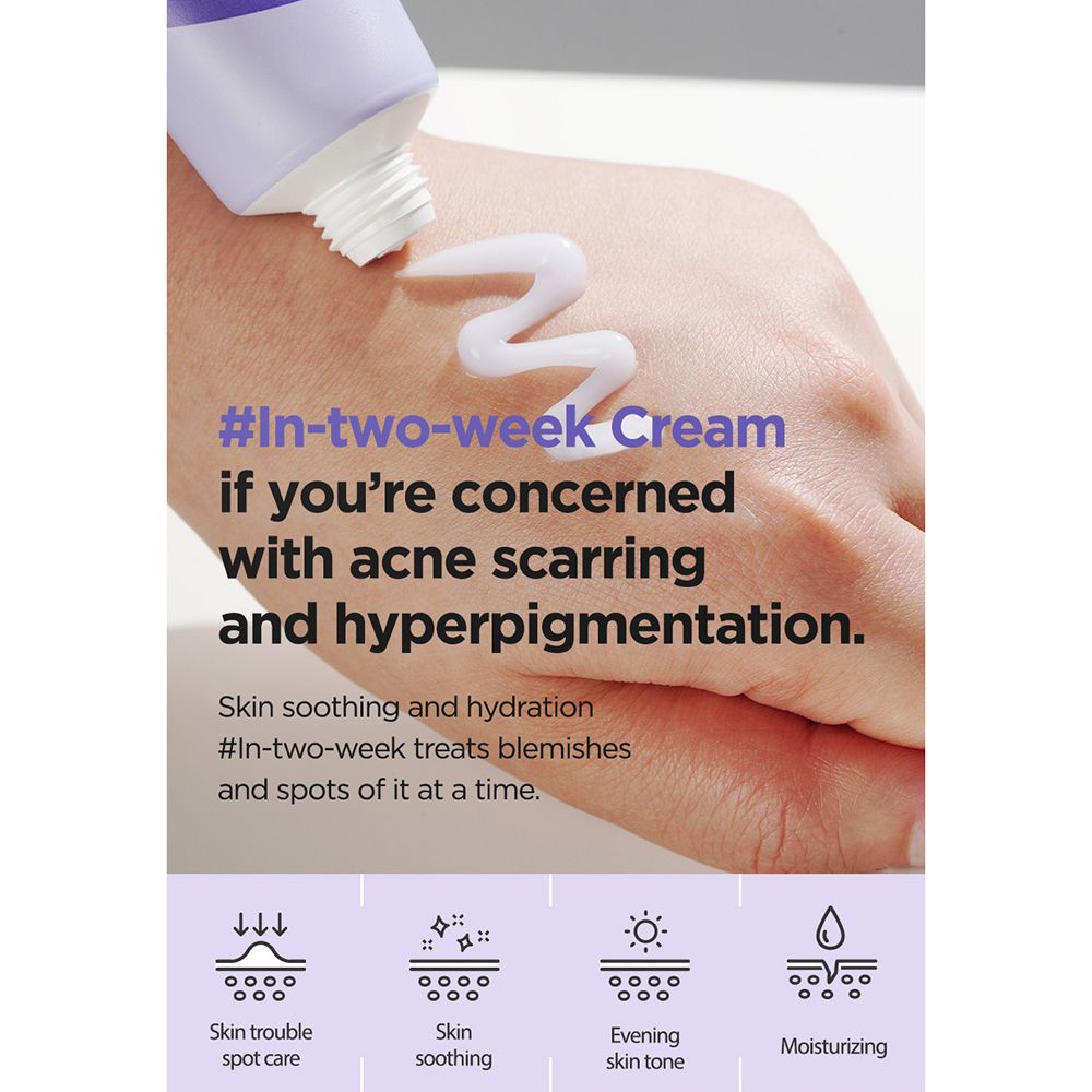 Hand met crème. Tube met tekst: ONION NEWPAIR GEL CREAM. Tekst: #In-two-week Cream. Bij acne en hyperpigmentatie.