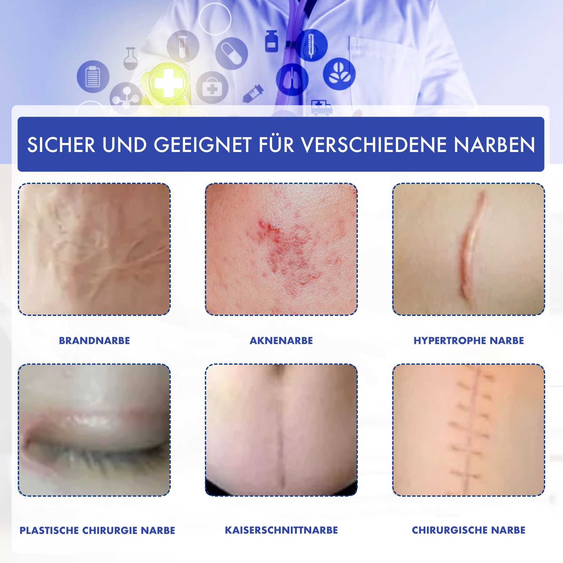Verschillende soorten littekens. Tekst: Brandwondlitteken, acne litteken, hypertrofisch litteken, plastische chirurgie, keizersnede litteken, chirurgisch litteken.