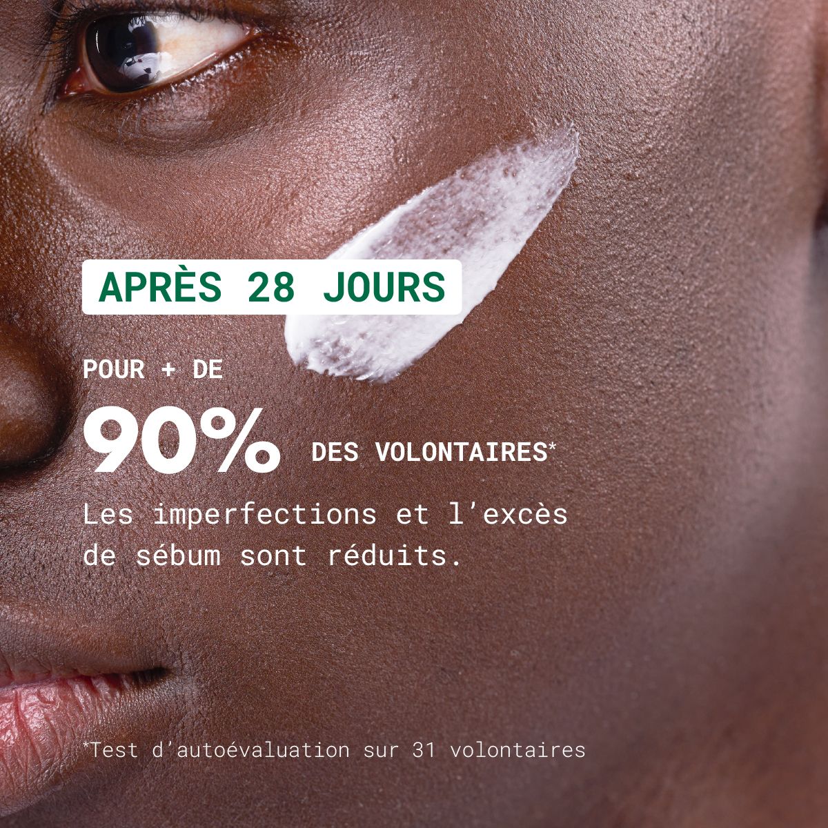 Gros plan sur un visage. Texte: Après 28 jours, plus de 90% des volontaires. Réduction des imperfections.