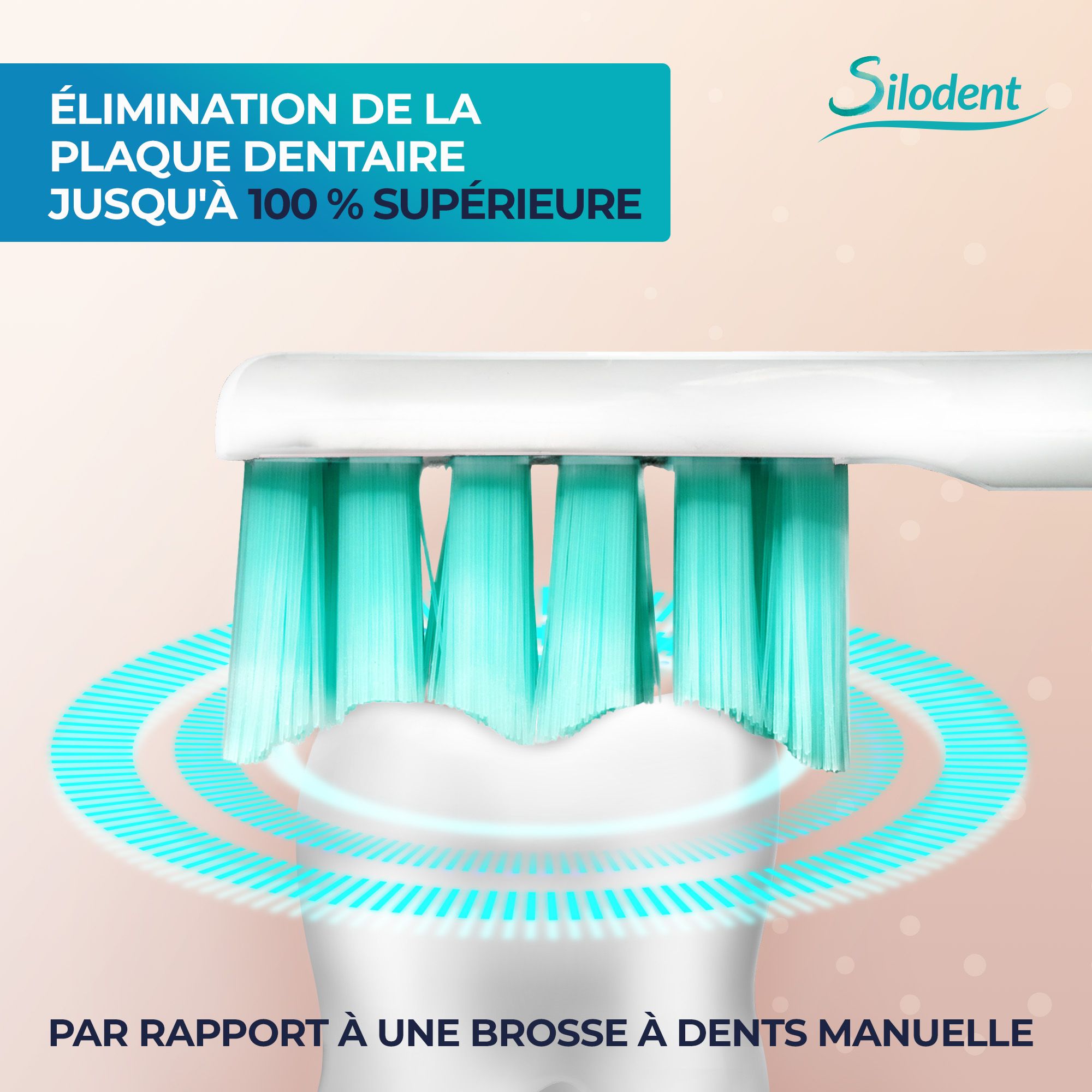 Brosse à dents sonique Silodent en action pour l'élimination de la plaque, comparée à une brosse manuelle.