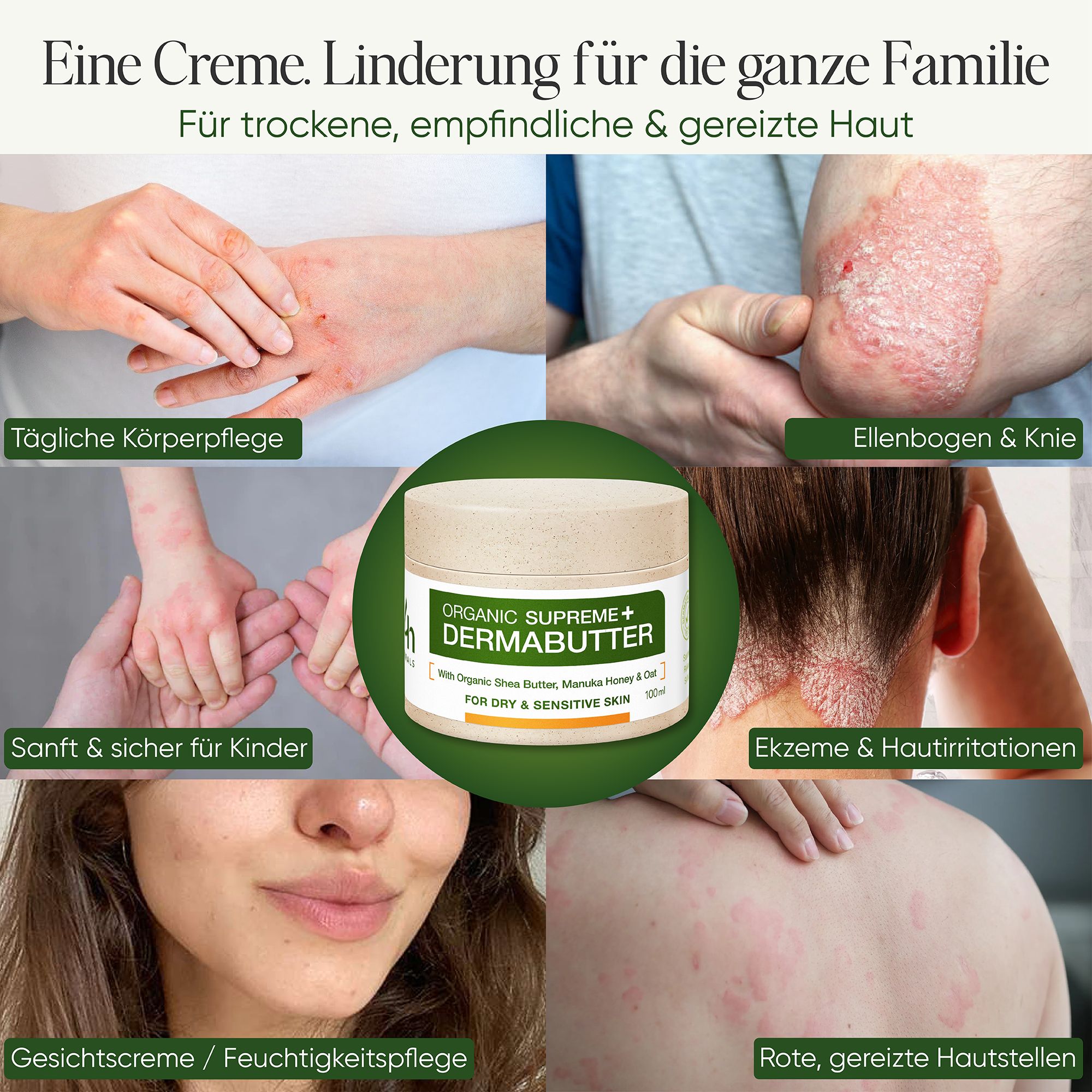 Productafbeelding met gebruiksvoorbeelden. Tekst: Een crème. Verlichting voor het hele gezin. Voor droge, gevoelige huid.
