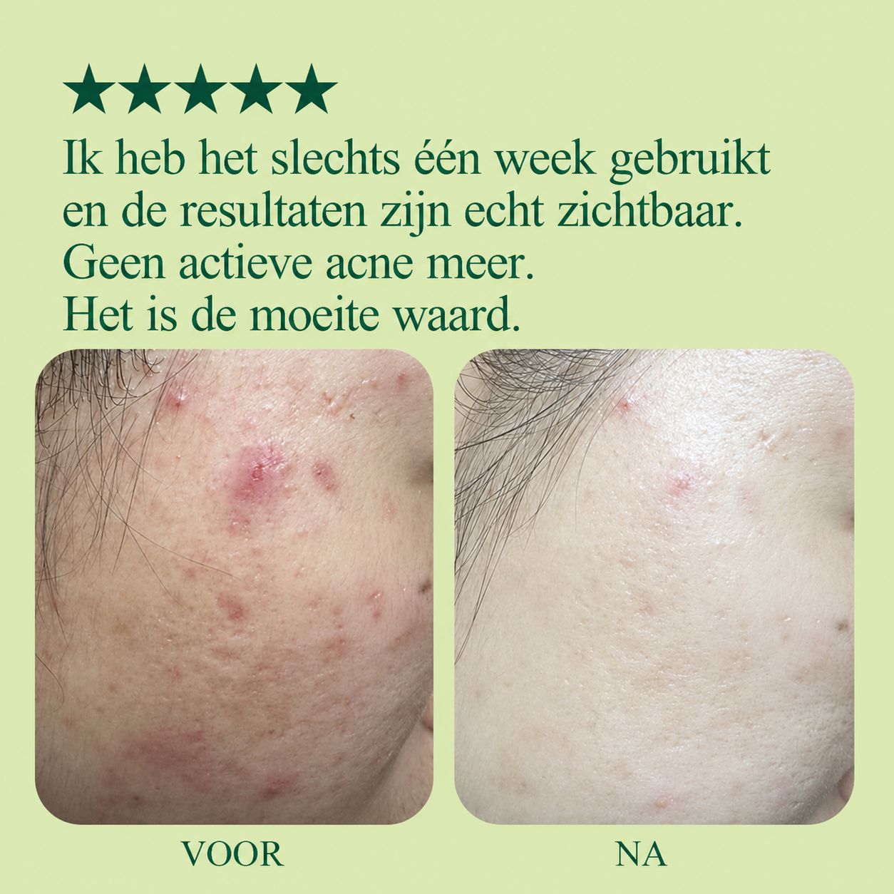 Grafiek toont effectiviteit: Huidbarrière +10%, Roodheid -13%, Talg -47%.