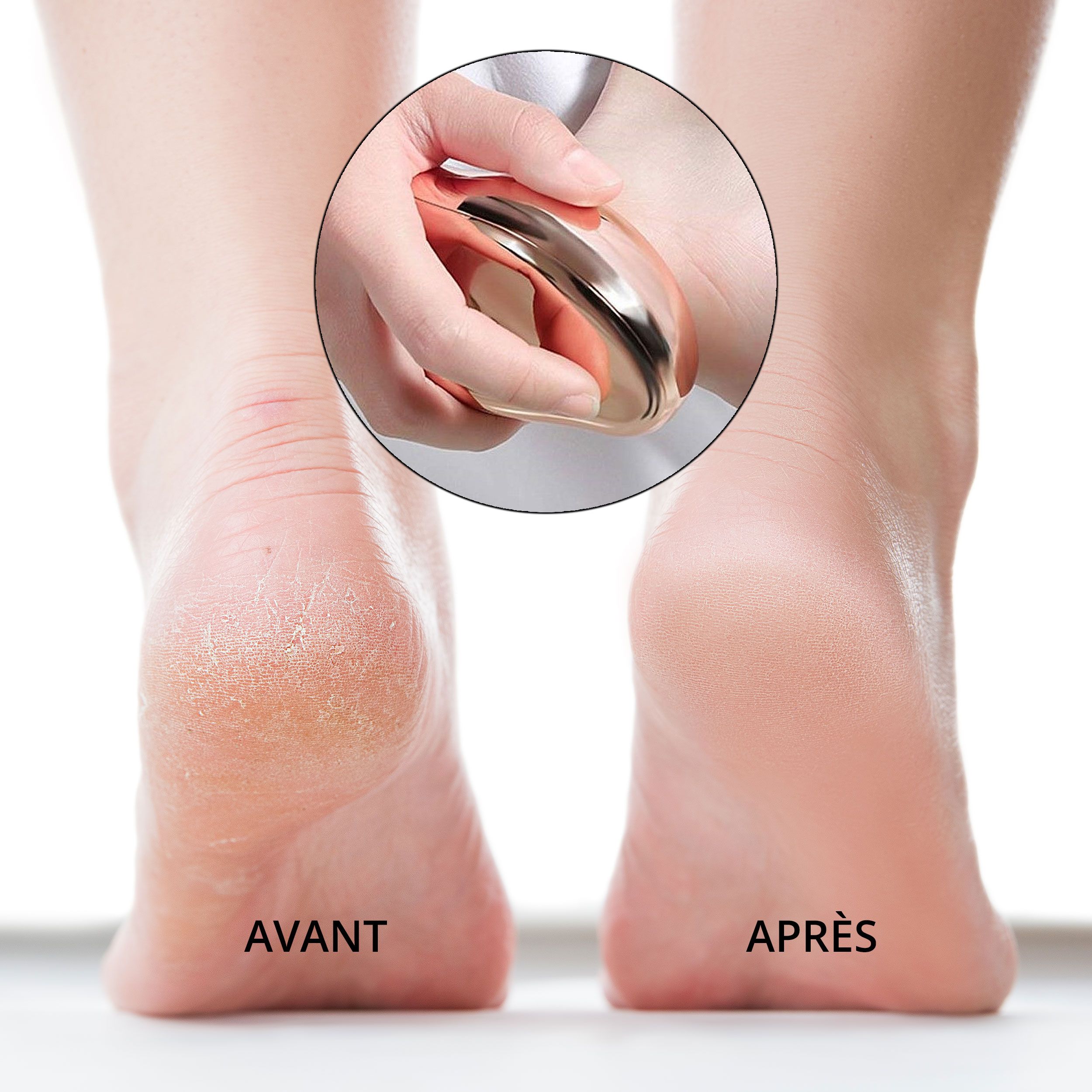 Pieds avant et après traitement. En cercle: appareil de soin des pieds en cours d'utilisation.