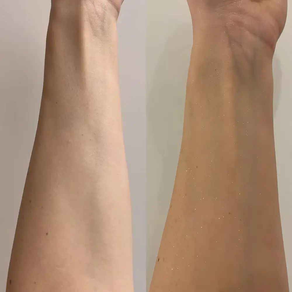 Deux bras, un non bronzé, un bronzé. Des particules scintillantes sont visibles sur le bras bronzé.