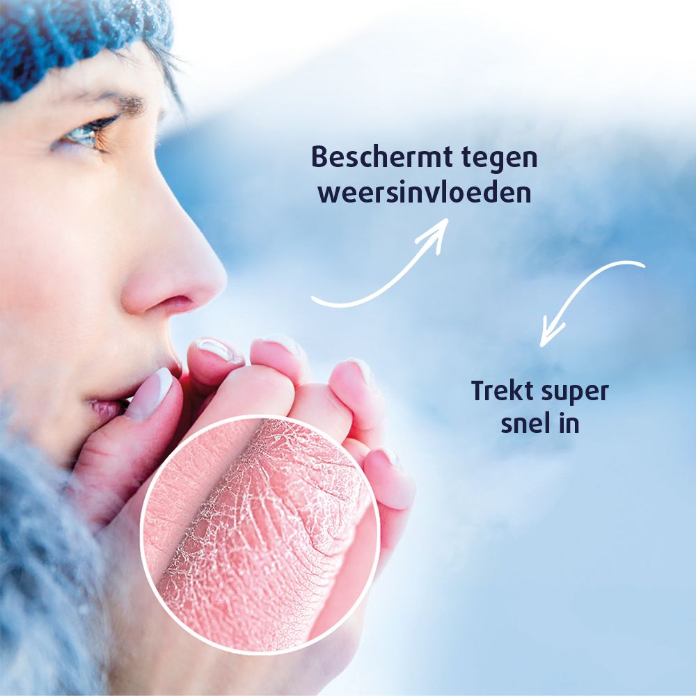 Close-up van persoon in de winter. Uitgelichte, gebarsten huid. Tekst: Beschermt tegen weersinvloeden, trekt super snel in.