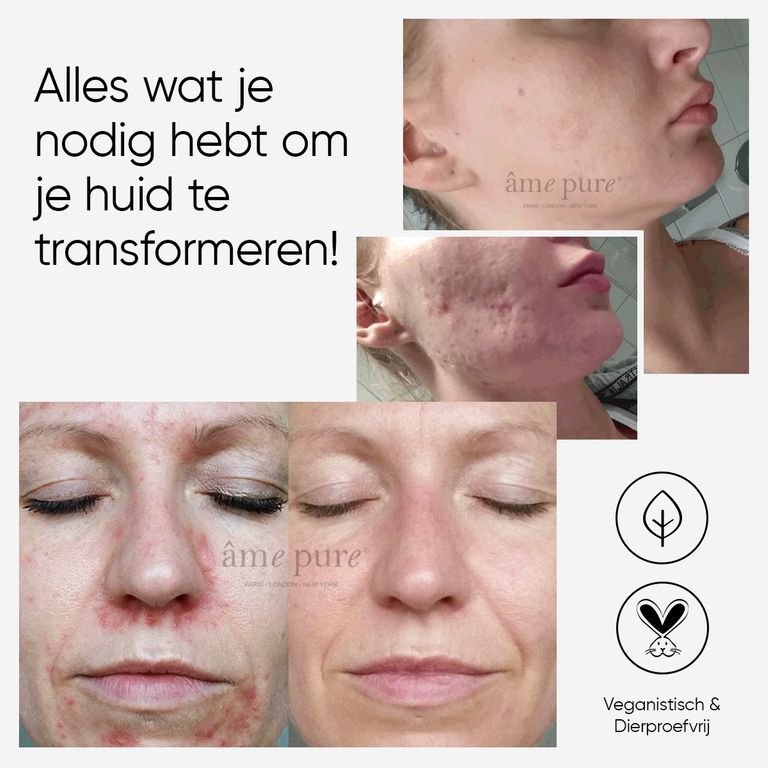 Gebruiksaanwijzing voor de CIT Face Roller.