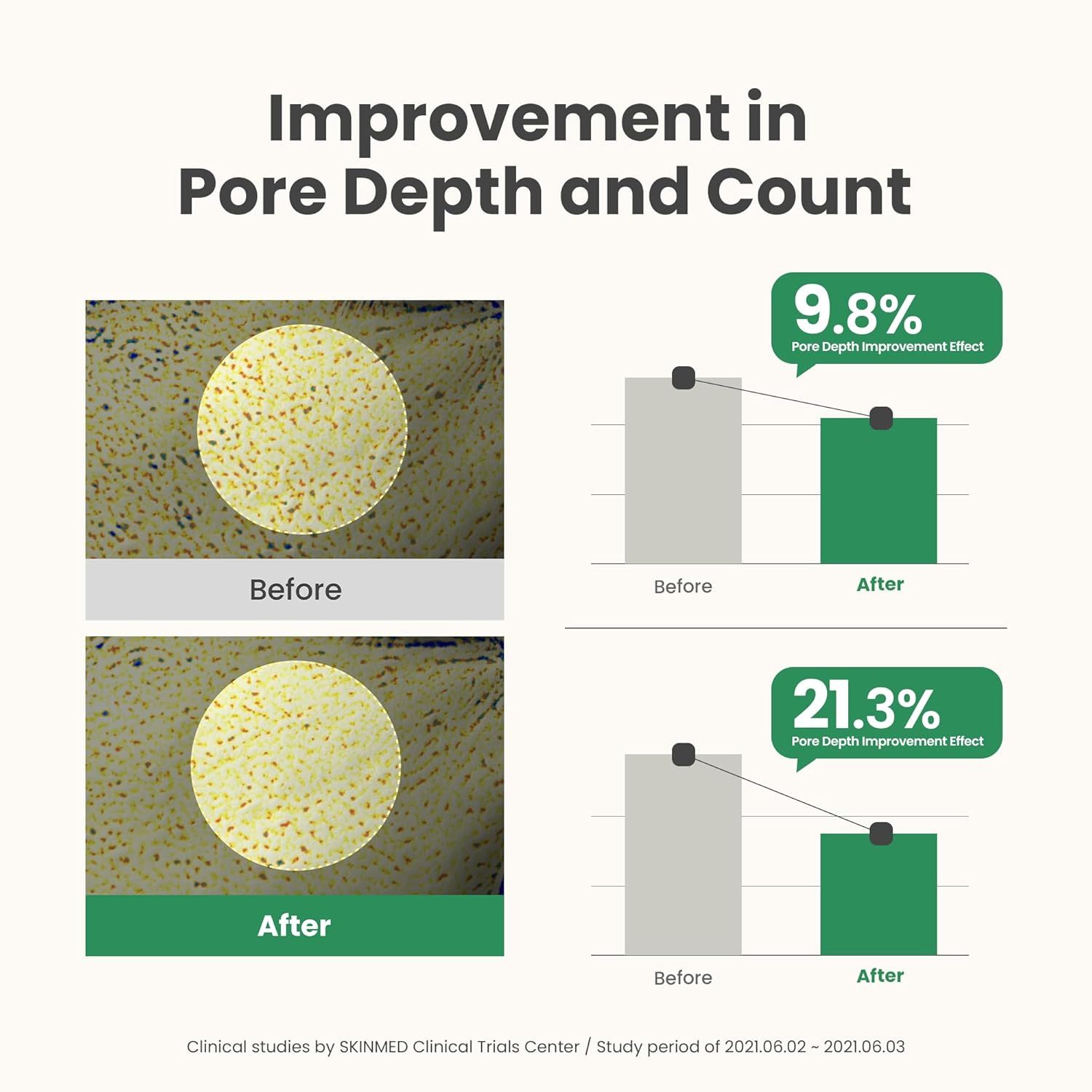 Grafiek: verbetering van poriegrootte. Voor-en-na vergelijking. Grafieken tonen 9,8% en 21,3% verbetering.
