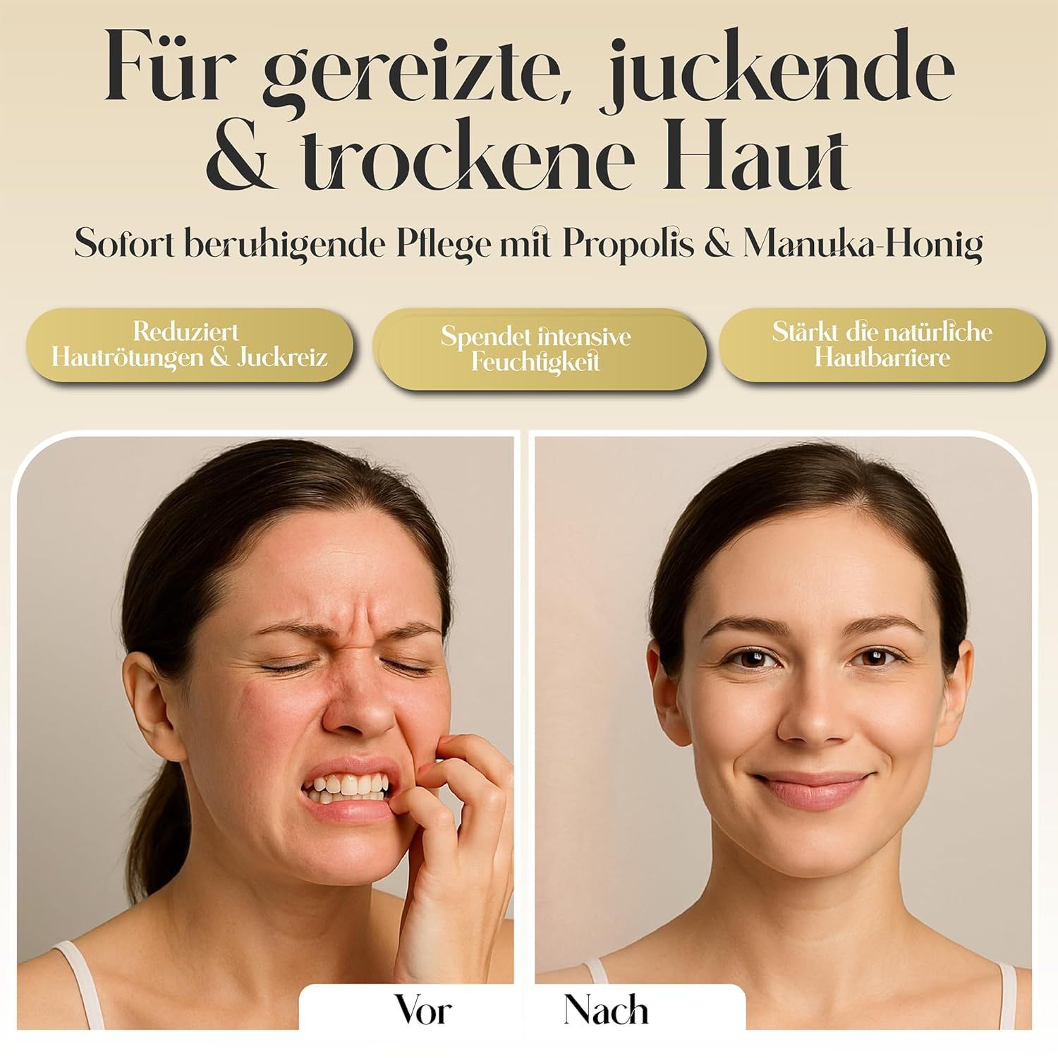 Voor-na. Vrouw krabt, dan glimlacht ze. Tekst: 'Für gereizte, juckende & trockene Haut'. Tekst: 'Reduziert Hautrötungen & Juckreiz'.