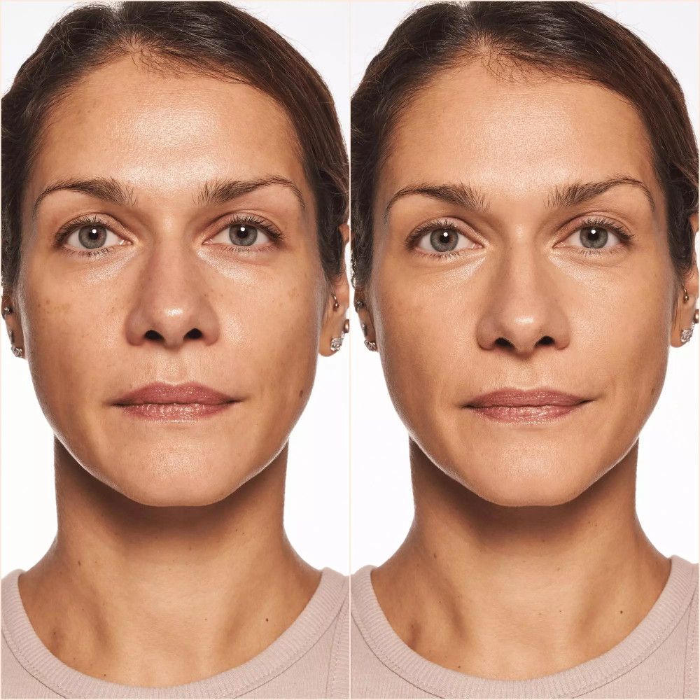 Comparaison avant-après. Femme avec visage non maquillé et avec fond de teint. Différence notable de teint.