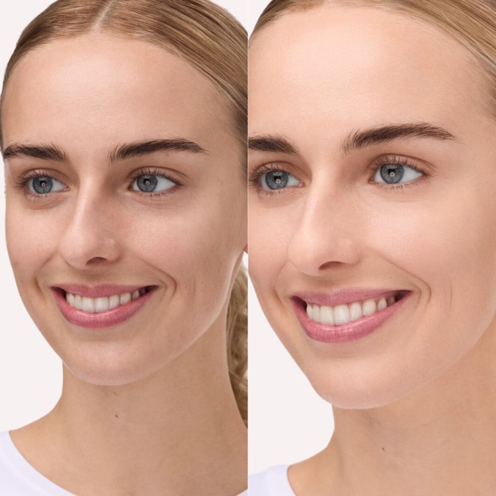 Vergelijking: gezicht voor en na gebruik. Huid ziet er egaler en stralender uit. Vrouw met lichte teint.