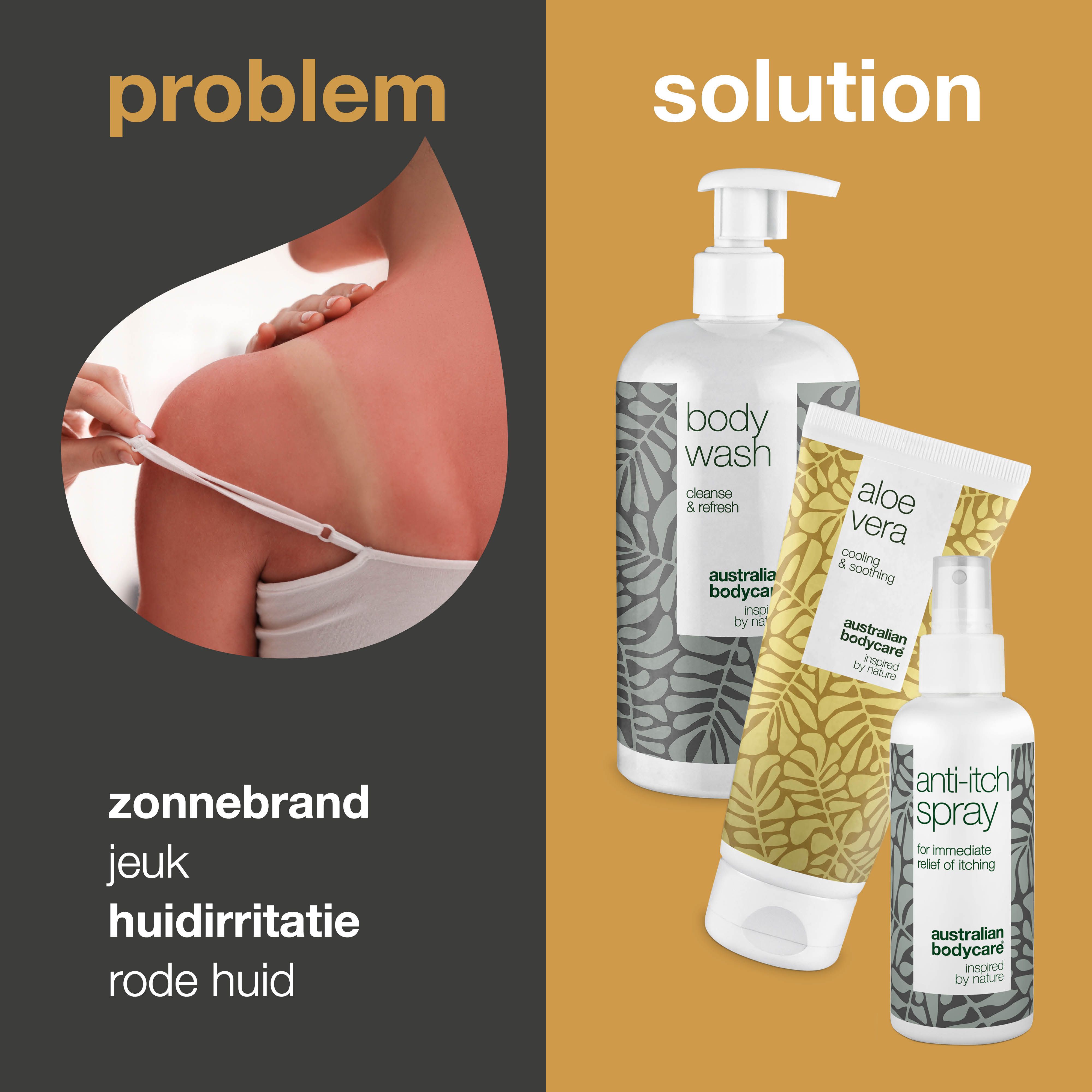 Zonnebrandprobleem en oplossing. Rechts: Body Wash, Aloe Vera gel en Anti-jeuk Spray.