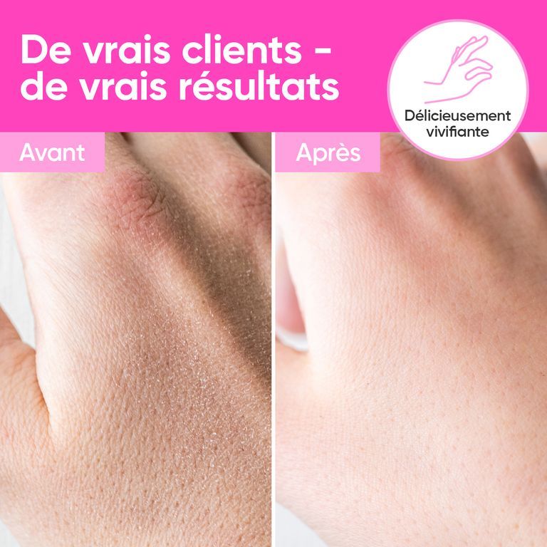 Comparaison avant-après de mains traitées avec de la crème. Texte en français.